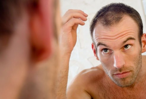 Does Dimethicone Cause Hair Loss?