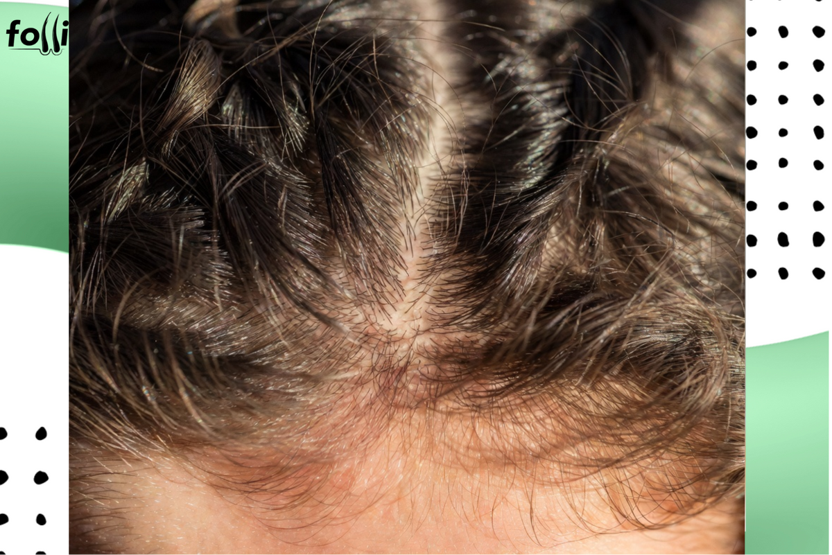 Is Your Shampoo Making Your Hair Greasy? Causes and Fixes