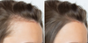Can Estrogen Stop Body Hair Growth? What Science & Experts Reveal