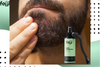 Beard Dandruff and Itchiness Prevention: Year-Round Solutions by Hair Folli