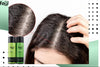 Can an Itchy Scalp Mean Hair Growth? Real Signs & Expert Truths