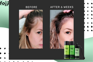 Hair Folli Customer Stories: Real Hair Growth Results & Transformations