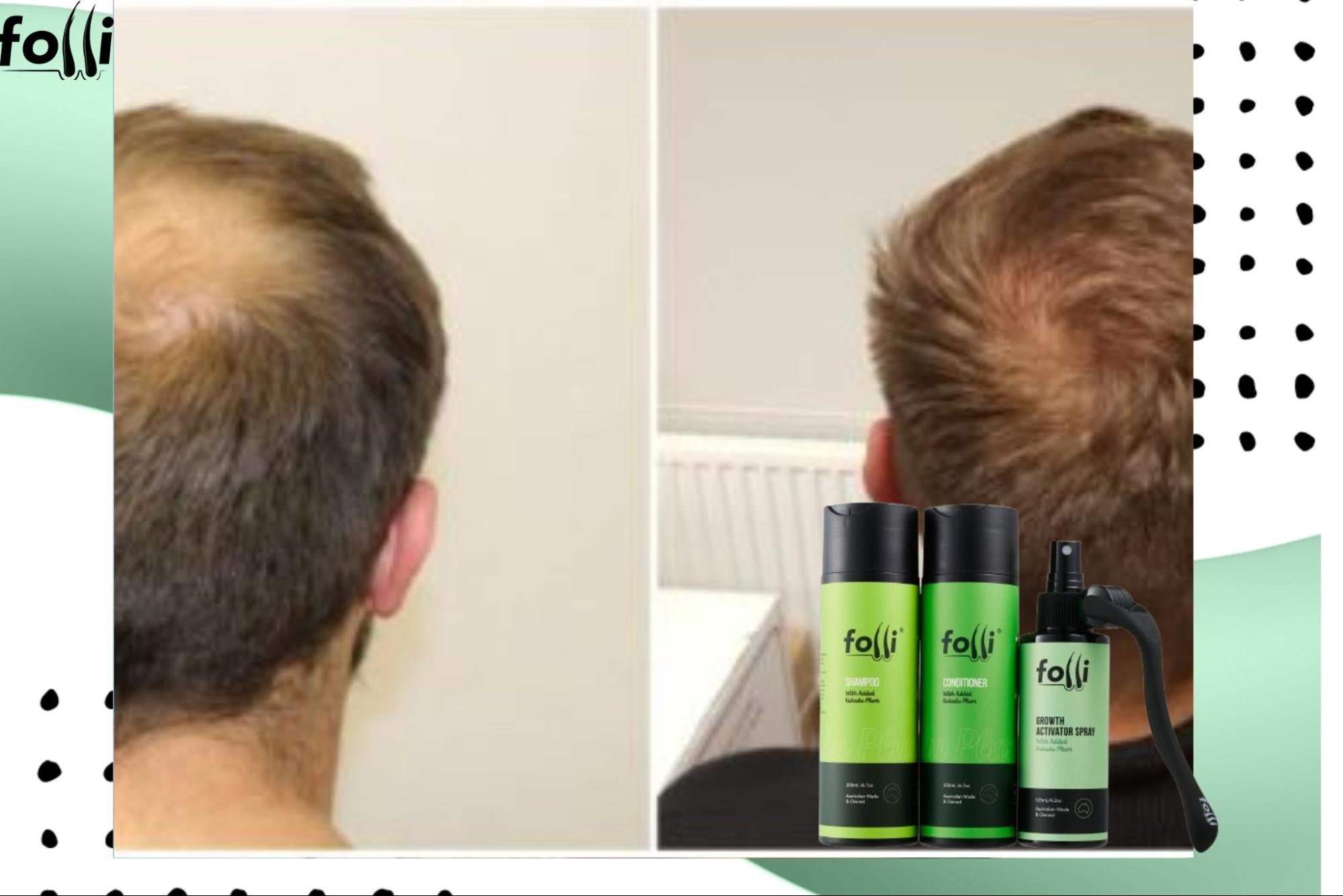How Long Does It Take to See Hair Growth? Real Timelines for Aussies