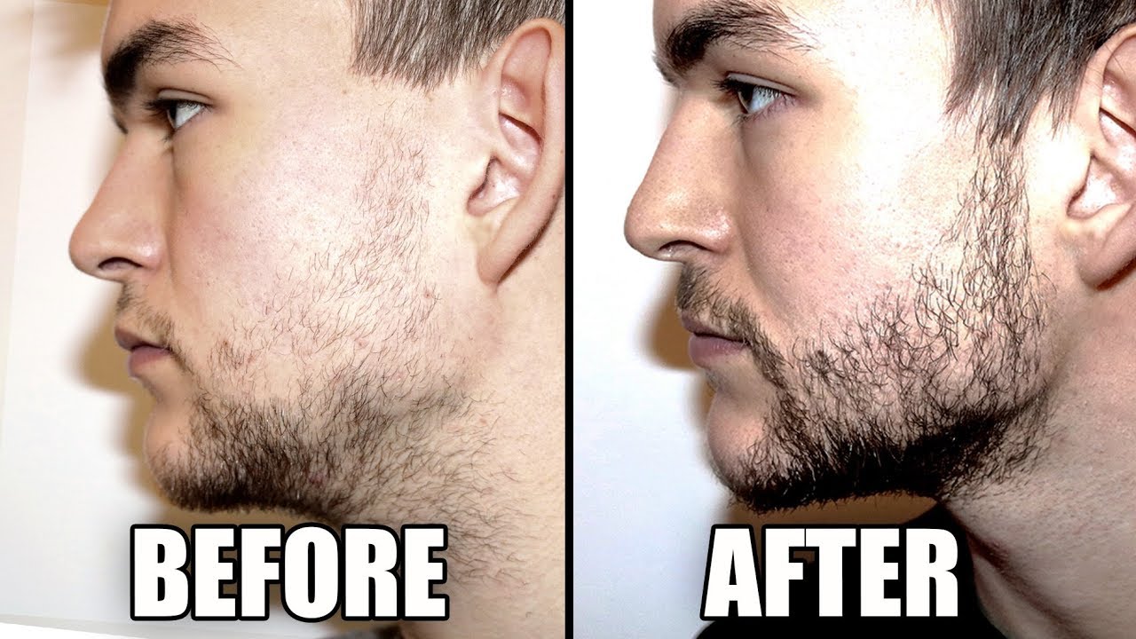 Do Beard Growth Kits Work? Top Treatments and Remedies of 2025
