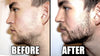 Do Beard Growth Kits Work? Top Treatments and Remedies of 2025