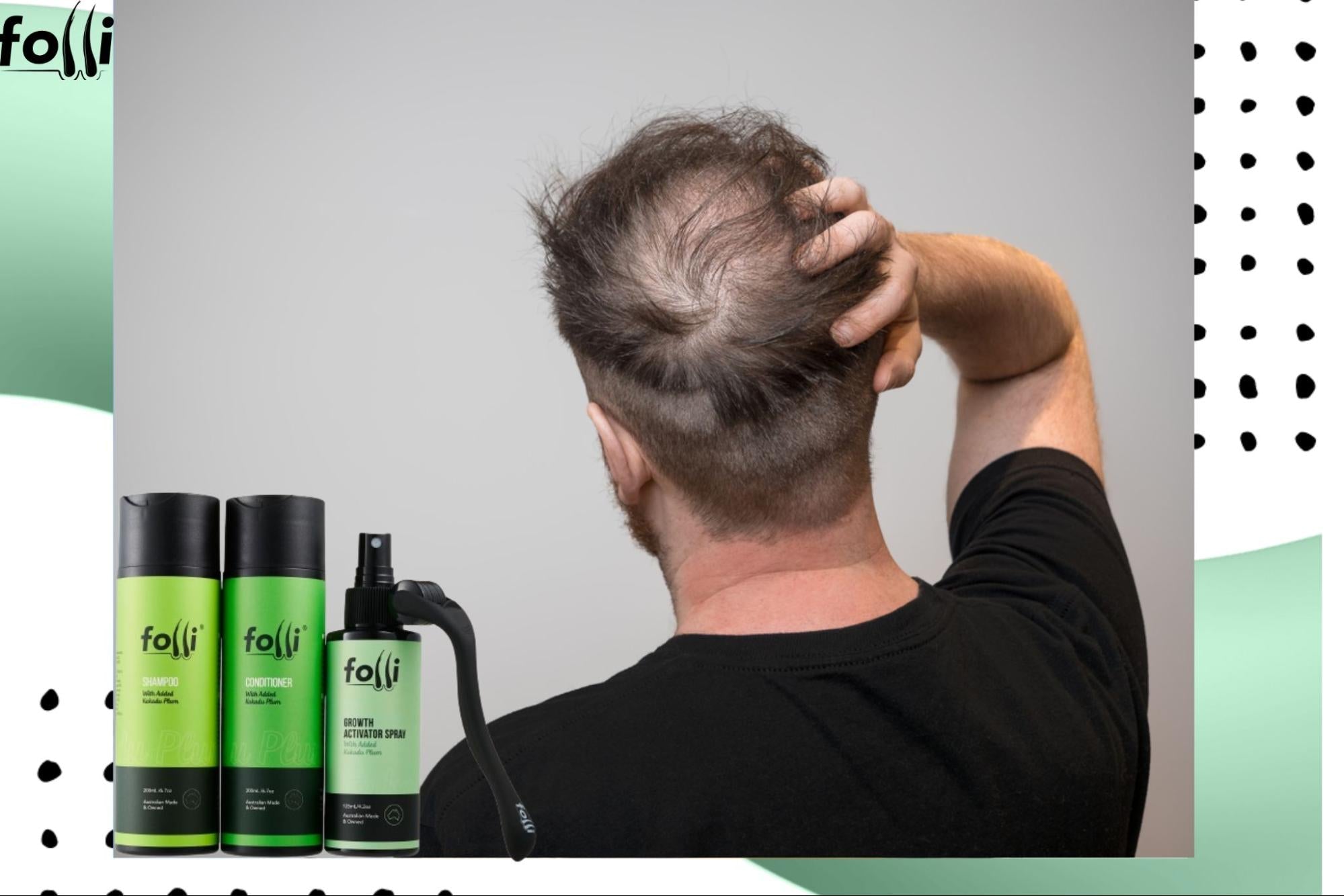 How to Regrow Bald Patches Naturally: Proven Remedies That Work
