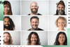 Men vs Women Hair Loss: How It Differs & What Actually Works – Hair Folli