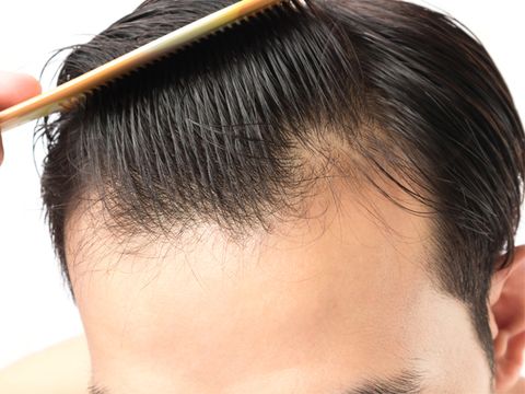 Does Omicron Cause Hair Loss?