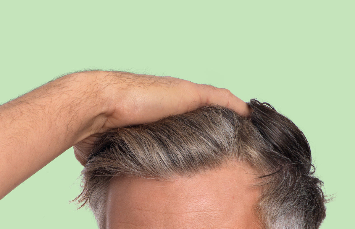 Early Signs of Hair Loss