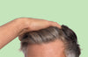 Early Signs of Hair Loss