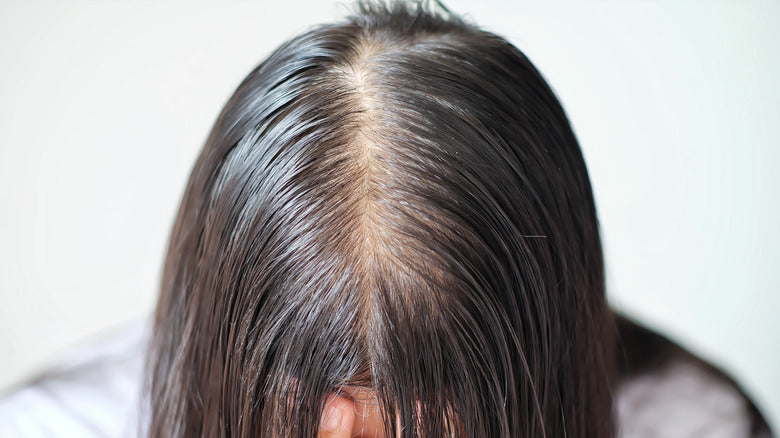 Hair loss hair loss hair root - Stock Illustration [22317041] - PIXTA