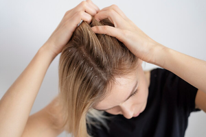 Natural Remedies for Itchy Scalp: Effective Home Treatments