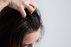 How to Manage Oily Scalp: Best Tips & Products