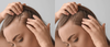 Anti Hair Loss Shampoo: Sydney’s Best Solutions & Where to Buy