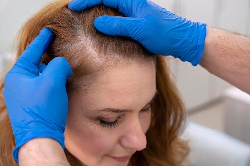 Collagen for Hair Growth: Key Benefits and How It Works