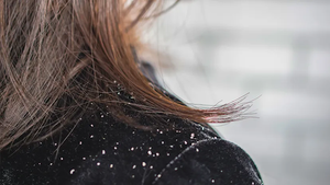 Anti Dandruff Shampoo: Hair Folli’s Best Picks for Flake-Free Hair