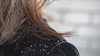 Anti Dandruff Shampoo: Hair Folli’s Best Picks for Flake-Free Hair