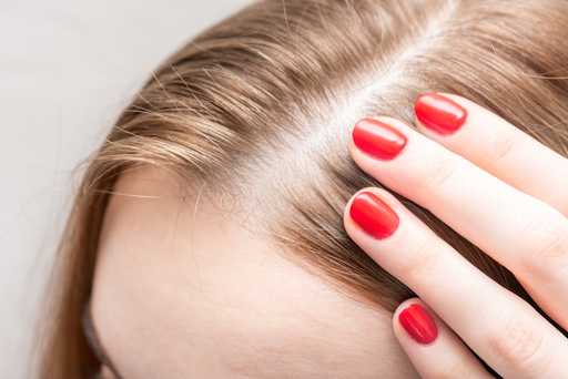 How to Stop Hair Thinning Naturally: Proven Remedies That Work