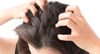 Effective Solutions for Flake-Free, Healthy Hair