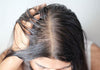 Recommended Shampoo for Greasy Hair: Pro Picks & Fast Fixes for Fresh Locks