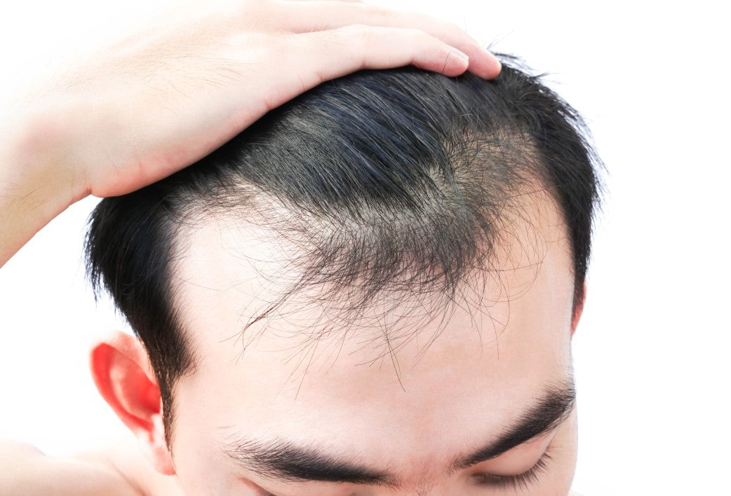 Best Treatment for Hair Loss: Expert Options & Natural Remedies