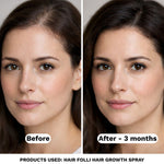 Before and after comparison of a woman's hair with text indicating product use for hair growth.