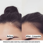 Hair Mask for Hair Growth
