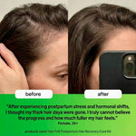Postpartum Hair Loss Treatment [Spray, Serum, Mask & More]