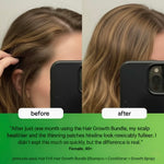 Hair Growth Bundle with Spray, Shampoo & More
